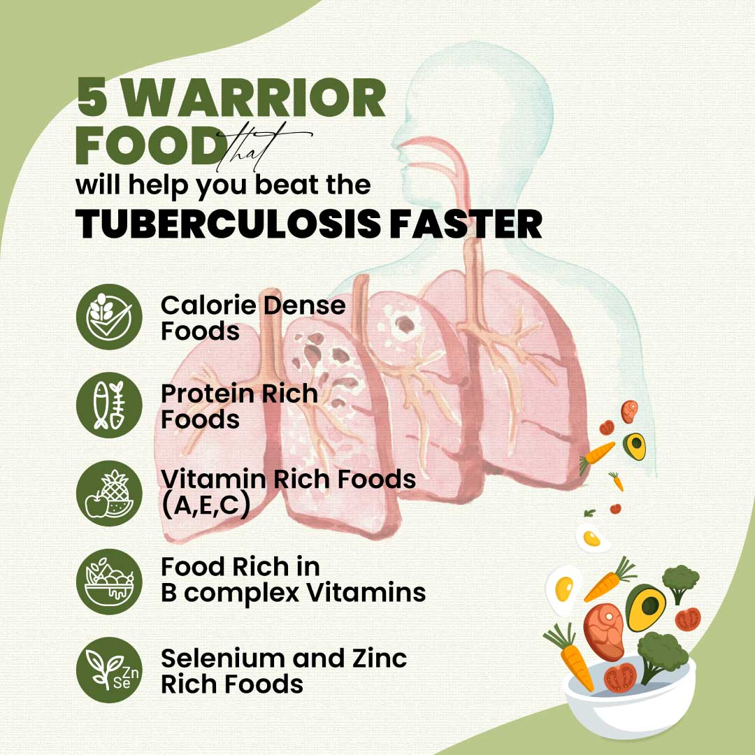 Envigor Nutritional Health Supplements Products a-proper-diet-can-keep-tuberculosis-at-bay-the-hindu